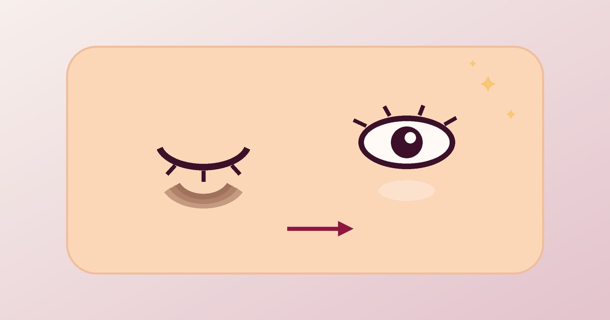 Dark Circles That Won’t Go Away: Causes and Treatments That Actually Work
