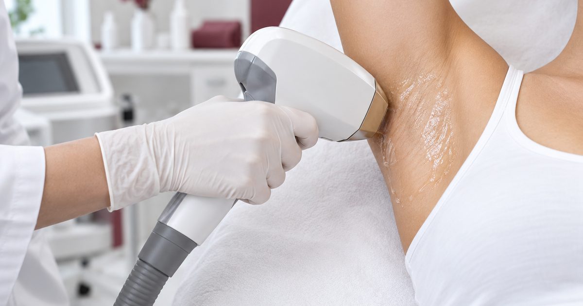 Dark Underarms: Why Shaving Causes Them and How Laser Hair Removal Helps