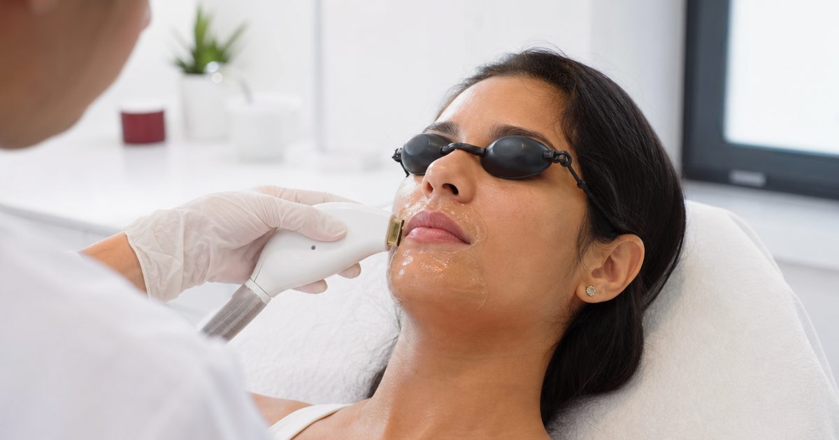 PCOS and Unwanted Facial Hair: What Actually Works