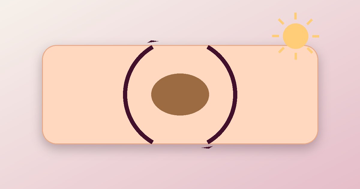 Why Does Your Pigmentation Keep Coming Back?